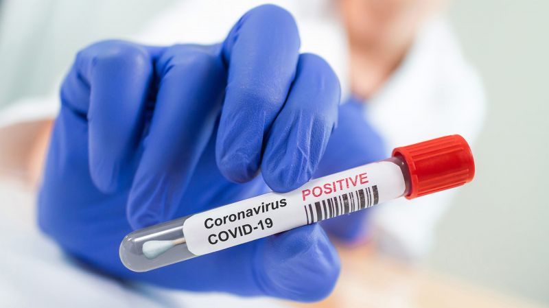 Coronavirus swab sample in doctor's hands.